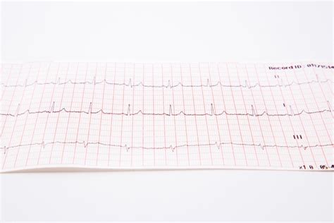 Cardiogram Pulse Trace Free Stock Photo - Public Domain Pictures