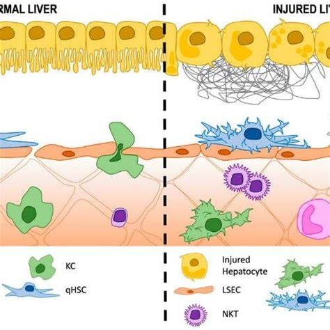 Role of Disse Space in normal conditions and injured liver. KC Kupffer... | Download Scientific ...