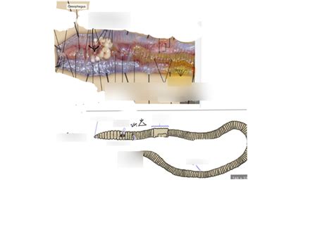 Diagram of Worm dissection | Quizlet