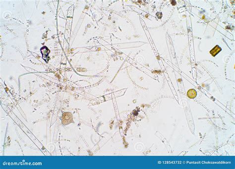 Marine Aquatic Plankton Under Microscope View Stock Photo - Image of ...