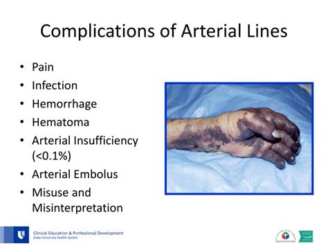 PPT - Arterial Line Management for the Birthing Center PowerPoint Presentation - ID:1570287