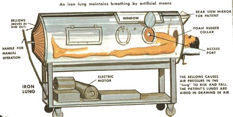 12 iron lungs