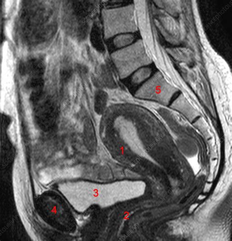 Normal female pelvis, MRI - Stock Image - C026/9014 - Science Photo Library