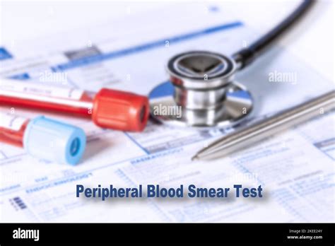 Peripheral blood smear test, conceptual image Stock Photo - Alamy