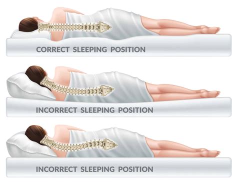 Proper Sleeping Position Neck Pain at Carrie Buchanan blog