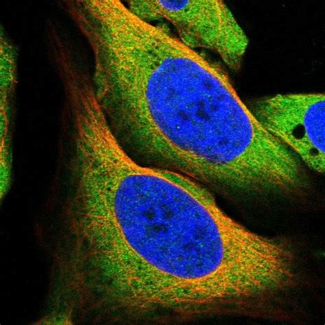 Anti-TRPML1/MG-2 antibody (ab272608) | Abcam