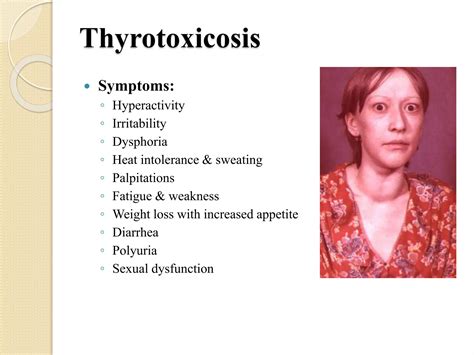 Thyroid Gland and Disease of Thyroid Gland