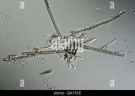 Mold filaments and spores from the Aspergillus mold under the ...