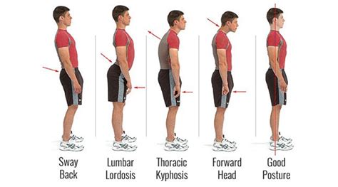 Posture Perfect: Are you standing the right way? | Fitness News - The Indian Express