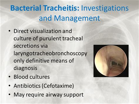 Bacterial tracheitis antibiotics