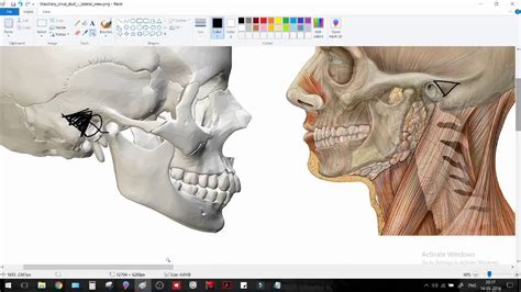 MacEwen's Triangle - Training in Surface anatomy (ENT / SURGERY ...