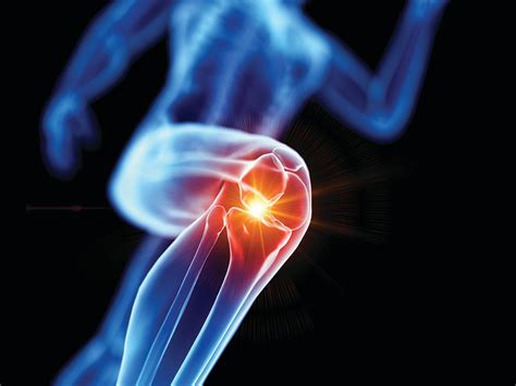 What is inflammation?