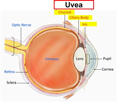 Iritis, Traumatic Iritis- Causes, Symptoms, Signs, Diagnosis, Treatment