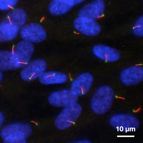 Imaging Cilia and Centrioles Below the Diffraction Limit - Microscopy