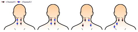 How To Use A Tens Unit For Shoulder Pain