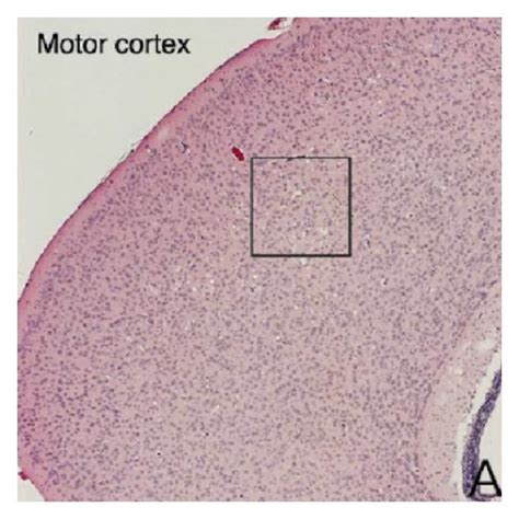 B-Sod2−/− exhibited distinct spongiform encephalopathy in the brain ...