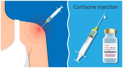 PRP or cortisone for shoulder pain. A Quick review