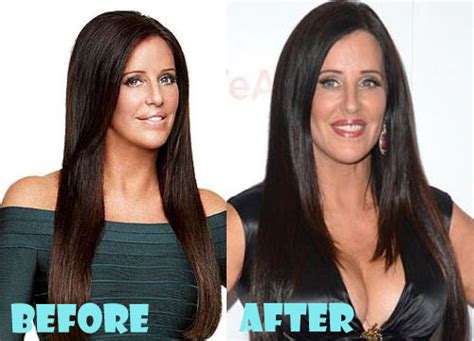 Patti Stanger Plastic Surgery Before and After Pictures - Lovely Surgery