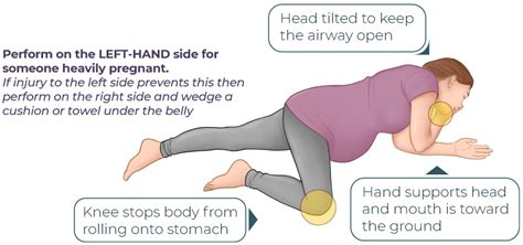 How CPR is performed on a pregnant person