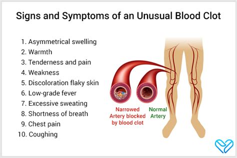 10 Signs & Symptoms of an Unusual Blood Clot - eMediHealth