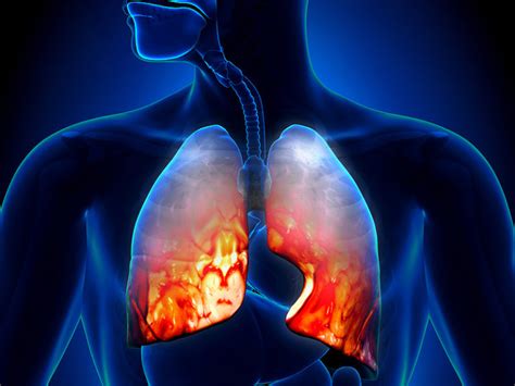 Respiratory Care Week; Acute lower respiratory infections! | Strive For Good Health