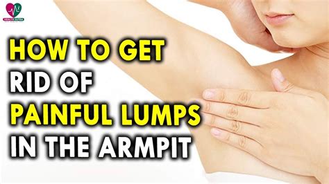 What Causes Armpit Lumps - These cysts and bumps can be painful, small ...