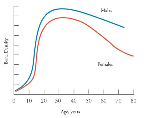 Osteoporosis: Basics, Symptoms, Causes and Prevention - Keep Vitality