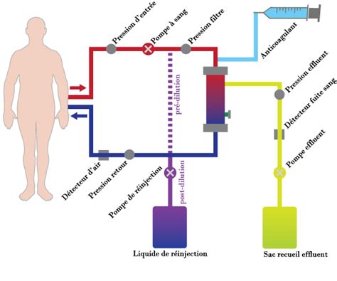 Epuration extra-rénale : hémofiltration - Pratiques de soins - Soins ...