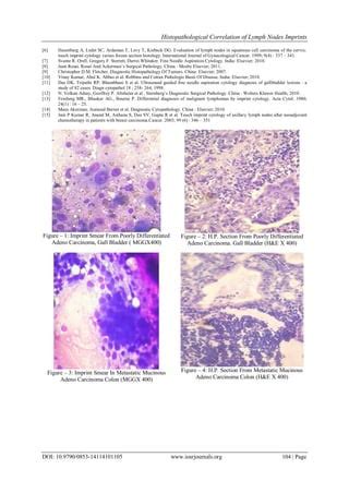 Histopathological Correlation of Lymph Nodes Imprints | PDF