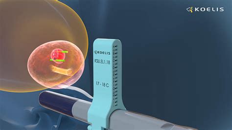 Transperineal Biopsy for Prostate Cancer Detection | KOELIS