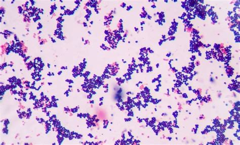 warna ungu pada bakteri adalah - Leonard Black