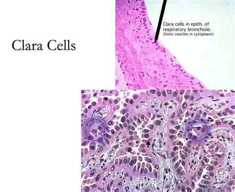 Respiratory - Clara Cells - Histology | Science notes, Teaching biology, Tools for teaching