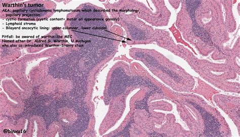 Thread by @BinXu16: "A to Z alphabet in A: angioinvasive fungal ...