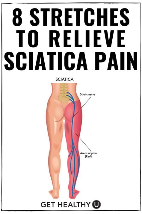 Sciatica relief in 8 minutes – Artofit