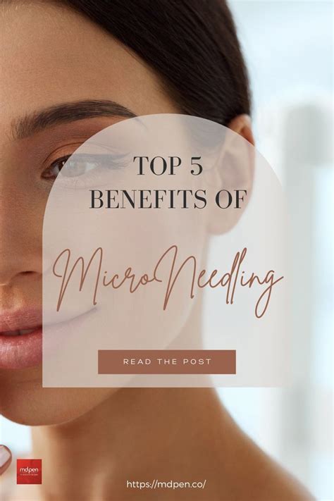 The Top 5 Benefits Of MicroNeedling | Microneedling, Skin needling, Skin care center