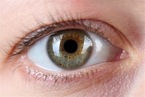 Eye Freckles? Dark Spots on Iris Linked to Sun Exposure, Risk of ...