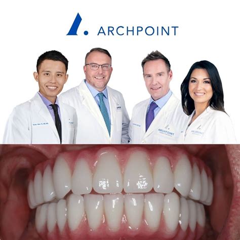 Dental Implants - ARCHPOINT Implant Dentistry