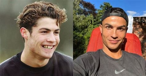 Cristiano Ronaldo Plastic Surgery Journey | Vanity