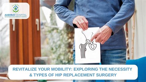 Exploring the Necessity and Types of Hip Replacement Surgery