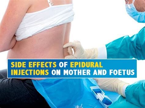 Pregnancy And Birth: Side Effects of Epidural Injections On Mother And Foetus - Boldsky.com