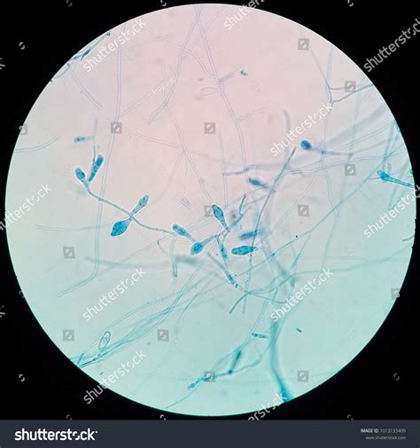 Epidermophyton Floccosum Under Microscope Stock Photo (Edit Now) 1013133409