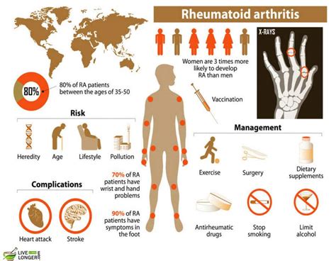 10 Best Home Remedies For Arthritis That Incredibly Work