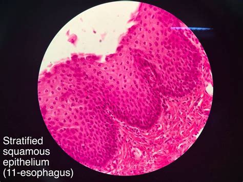 Stratified Squamous Epithelium Diagram