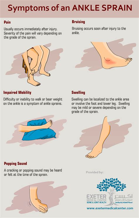 Ankle Sprains are a common injury that occur from over stretching or tearing of the ligaments ...