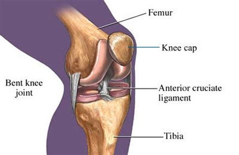 THE POSSIBLE COMPLICATIONS OF ACL RECONSTRUCTION | by The Joint Clinic | Medium