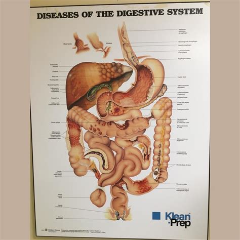 Diseases of the digestive system