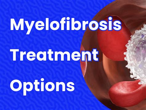 Myelofibrosis Treatment Options | Massive Bio