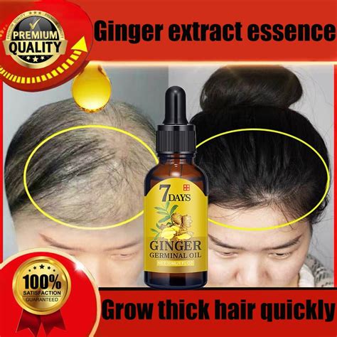 7 DAYS Ginger Germinal Oil Ginger Hair Growth Essence Hair Loss Liquid ...