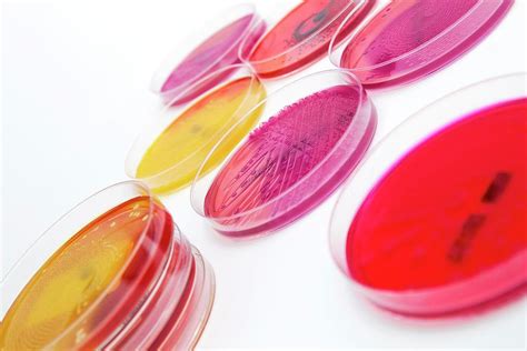 Agar Plates Photograph by Daniela Beckmann / Science Photo Library - Pixels