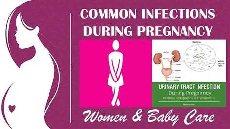 Urinary Tract Infection UTI Infections during pregnancy by Women & Baby Care - YouTube